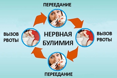Лечение булимии в Менделеевске